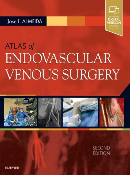 [eBook] [PDF] Atlas of Endovascular Venous Surgery 2nd Edition BY Jose Almeida