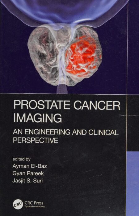 eBook(scan copy) Prostate Cancer Imaging 1st Edition Ayman El-Baz , Gyan Pareek, jasjit S. Suri