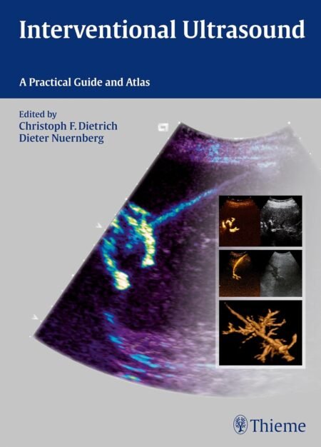 eBook Interventional Ultrasound 1st edition By Christoph Frank Dietrich ,Dieter Nürnberg